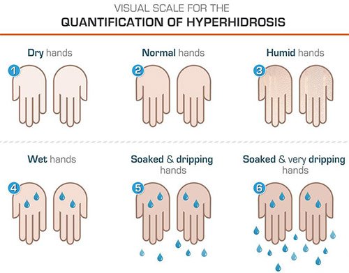 Do you have hyperhidrosis?