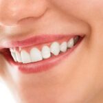 Why Does Every Person Need Whiter and Brighter Smile?