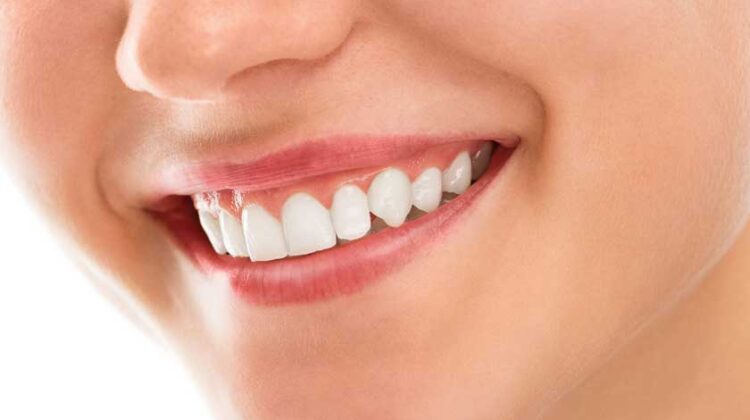 Why Does Every Person Need Whiter and Brighter Smile?