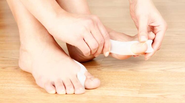 Is Bunion Splint worth it, Know from the Experts